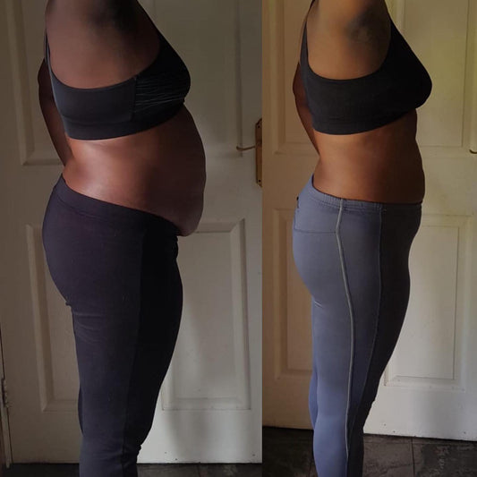 What Causes Belly Fat?